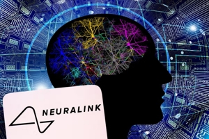 Η Neuralink ανακοίνωσε την πρώτη εμφύτευση μικροτσίπ σε ανθρώπινο εγκέφαλο